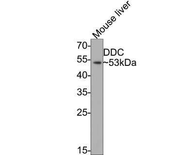 Western Blot: Dopa Decarboxylase/DDC Antibody (JA53-16) [NBP2-66806] - Analysis of Dopa Decarboxylase/DDC on mouse liver tissue lysates with Rabbit anti-Dopa Decarboxylase/DDC antibody at 1/500 dilution. Lysates/proteins at 20 ug/Lane. Predicted band size: 53 kDa Observed band size: 53 kDa. Exposure time: 2 minutes; 10% SDS-PAGE gel. Proteins were transferred to a PVDF membrane and blocked with 5% NFDM/TBST for 1 hour at room temperature. The primary antibody at 1/500 dilution was used in 5% NFDM/TBST at room temperature for 2 hours. Goat Anti-Rabbit IgG - HRP Secondary Antibody at 1:200,000 dilution was used for 1 hour at room temperature.