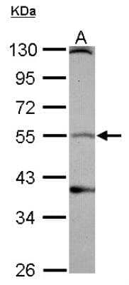 Western Blot: Dopamine D1 R/DRD1 Antibody [NBP2-16214] - Sample (30 ug of whole cell lysate) A: IMR32 10% SDS PAGE gel, diluted at 1:1000.