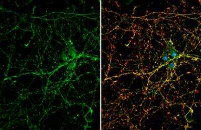 Immunocytochemistry/Immunofluorescence: Dopamine D1R/DRD1 Antibody [NBP2-16214] - Dopamine Receptor D1 antibody [N1], N-term detects Dopamine Receptor D1 protein by immunofluorescent analysis. Sample: DIV10 rat E18 primary cortical neuron cells were fixed in 4% paraformaldehyde at RT for 15 min. Green: Dopamine Receptor D1 stained by Dopamine Receptor D1 antibody [N1], N-term diluted at 1:500. Red: beta Tubulin 3/ Tuj1, stained by beta Tubulin 3/ Tuj1 antibody [GT11710] diluted at 1:500. Blue: Fluoroshield with DAPI.