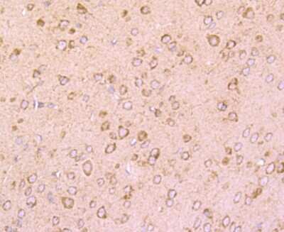 Immunohistochemistry-Paraffin: Dopamine D1R/DRD1 Antibody (JM10-93) [NBP2-66807] - Analysis of paraffin-embedded mouse brain tissue using anti-DRD1 antibody. Counter stained with hematoxylin.