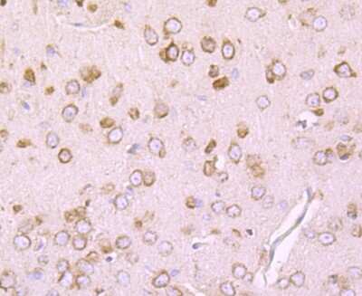 Immunohistochemistry-Paraffin: Dopamine D1R/DRD1 Antibody (JM10-93) [NBP2-66807] - Analysis of paraffin-embedded rat brain tissue using anti-DRD1 antibody. Counter stained with hematoxylin.