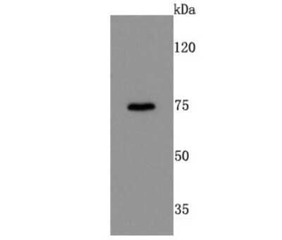 Western Blot: Dopamine D1R/DRD1 Antibody (JM10-93) [NBP2-66807] - Analysis of DRD1 on mouse kidney cells lysates using anti-DRD1 antibody at 1/500 dilution.