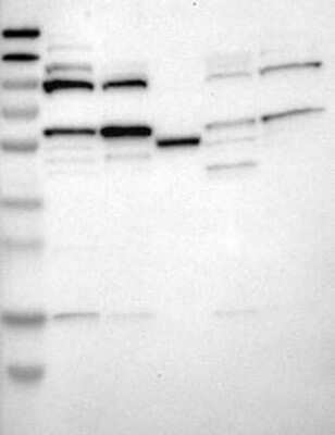 Western Blot: Dopamine D1R/DRD1 Antibody [NBP3-17644] - Lane 1: Marker [kDa] 230, 130, 95, 72, 56, 36, 28, 17, 11;   Lane 2: RT4;   Lane 3: U-251 MG;   Lane 4: Human Plasma;   Lane 5: Liver;   Lane 6: Tonsil