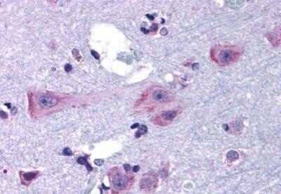 Immunohistochemistry-Paraffin: Dopamine D3R/DRD3 Antibody [NBP1-02398] - Staining of human brain, cortex tissue after heat-induced antigen retrieval. Antibody concentration 20 ug/ml.
