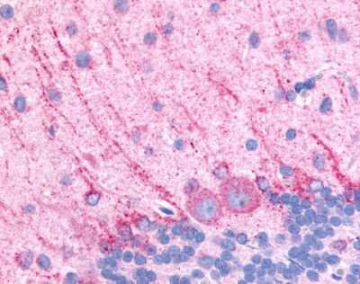 Immunohistochemistry-Paraffin: Dopamine D5 R/DRD5 Antibody [NLS1407] - Analysis of anti-DRD5 / Dopamine Receptor D5 antibody of rat brain, Purkinje neurons.