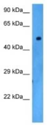 Western Blot: Dopamine D5R/DRD5 Antibody [NBP3-10782] - Western blot analysis of Dopamine D5R/DRD5 in Human 293T Whole Cell. Antibody dilution at 1.0ug/ml