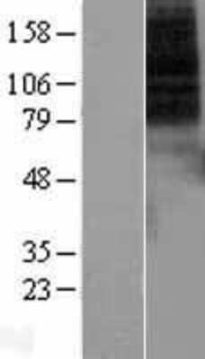 Western Blot: Dopamine Receptor D1 Overexpression Lysate (Adult Normal) [NBL1-10015] Left-Empty vector transfected control cell lysate (HEK293 cell lysate); Right -Over-expression Lysate for Dopamine Receptor D1.