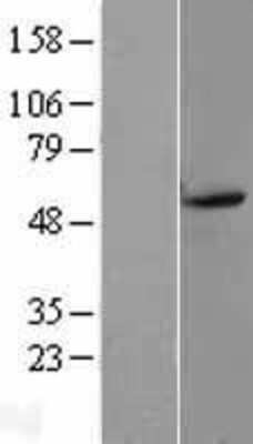 Western Blot: Dopamine Receptor D5 Overexpression Lysate (Adult Normal) [NBL1-10019] Left-Empty vector transfected control cell lysate (HEK293 cell lysate); Right -Over-expression Lysate for Dopamine Receptor D5.