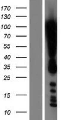 Western Blot: Dot1L Overexpression Lysate (Adult Normal) [NBL1-09984] Left-Empty vector transfected control cell lysate (HEK293 cell lysate); Right -Over-expression Lysate for Dot1L.