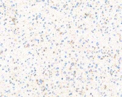 Immunohistochemistry-Paraffin: Doublecortin Antibody (BLR168J) [NBP3-14742] -  Rabbit anti-Doublecortin recombinant monoclonal antibody. Secondary:  HRP-conjugated goat anti-rabbit IgG. Substrate DAB