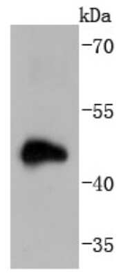 Western Blot: Doublecortin Antibody (JJ0959) [NBP2-66809] - Analysis of Doublecortin on human brain lysates using anti-Doublecortin antibody at 1/1,000 dilution.