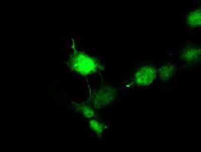 Immunocytochemistry/Immunofluorescence: Doublecortin Antibody (OTI4A3) - Azide and BSA Free [NBP2-70558] - Staining of COS7 cells transiently transfected by pCMV6-ENTRY Doublecortin.