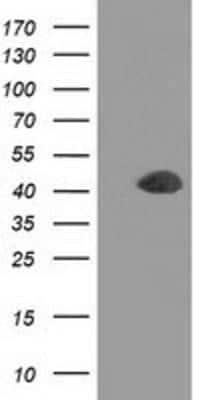 Western Blot: Doublecortin Antibody (OTI4A3) - Azide and BSA Free [NBP2-70558] - HEK293T cells were transfected with the pCMV6-ENTRY control (Left lane) or pCMV6-ENTRY Doublecortin (Right lane) cDNA for 48 hrs and lysed. Equivalent amounts of cell lysates (5 ug per lane) were separated by SDS-PAGE and immunoblotted with anti-Doublecor