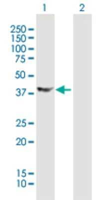 Western Blot: Doublecortin Antibody [H00001641-B01P] - Analysis of DCX expression in transfected 293T cell line by DCX polyclonal antibody.  Lane 1: DCX transfected lysate(39.6 KDa). Lane 2: Non-transfected lysate.