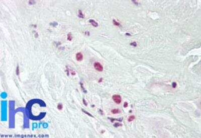 Immunohistochemistry-Paraffin: Dppa4 Antibody [NBP2-24656] - Formalin-fixed, paraffin-embedded human placenta stained with DPPA4 antibody at 10 ug/ml.