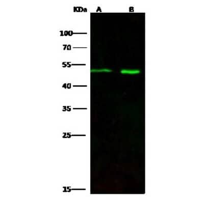 Western Blot: Draxin/C1orf187 Antibody [NBP2-97115] - Anti-Draxin/C1orf187 rabbit polyclonal antibody at 1:500 dilution. Lane A: Rat brain Tissue Lysate. Lane B: Mouse brain Tissue Lysate. Lysates/proteins at 30 ug per lane. Secondary Goat Anti-Rabbit IgG H&L (Dylight 800) at 1/10000 dilution. Developed using the Odyssey technique. Performed under reducing conditions. Predicted band size: 38 kDa. Observed band size: 50 kDa