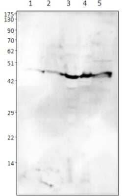 Western Blot: Draxin/C1orf187 Antibody [NBP3-12208] - WB of NBP3-12208 antibody- Rat hippocampus. Rat cortex. Mouse neonatal brain. Mouse adult brain. Rat ovary. Apparent MW is 42 kDa. 1:250 dilution in DiluObuffer. 