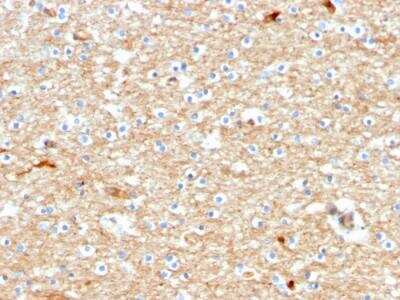 Immunohistochemistry-Paraffin: Drebrin 1 Antibody (DBN1/2880) - Azide and BSA Free [NBP2-79902] - Formalin-fixed, paraffin-embedded human Brain stained with Drebrin-1 Mouse Monoclonal Antibody (DBN1/2880).