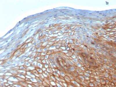 Immunohistochemistry-Paraffin: Drebrin 1 Antibody (DBN1/2880) - Azide and BSA Free [NBP2-79902] - Formalin-fixed, paraffin-embedded human Cervix stained with Drebrin-1 Mouse Monoclonal Antibody (DBN1/2880).