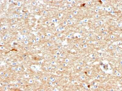 Immunohistochemistry-Paraffin: Drebrin 1 Antibody (DBN1/2880) [NBP2-79767] - Formalin-fixed, paraffin-embedded human Brain stained with Drebrin 1 Antibody (DBN1/2880).