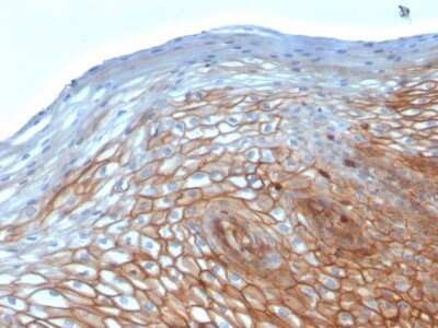 Immunohistochemistry-Paraffin: Drebrin 1 Antibody (DBN1/2880) [NBP2-79767] - Formalin-fixed, paraffin-embedded human Cervix stained with Drebrin 1 Antibody (DBN1/2880).