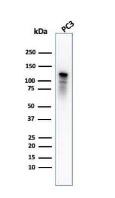 Western Blot: Drebrin 1 Antibody (DBN1/2880) [NBP2-79767] - Frozen mouse lung tissues of WT B6 and IL1R--/- (knockout) mice were blocked with 1% BSA in PBS and were double stained with Alex647-conjugated CD31/PECAM-1 antibody (MEC 7.46) and PE-conjugated F4/80 for 2 hours at the room temperature. Image using the Alexa Fluor 647 format of this antibody.