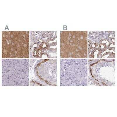 <b>Independent Antibodies Validation. </b>Immunohistochemistry-Paraffin: Drebrin 1 Antibody [NBP2-38813] - Staining of human cerebral cortex, kidney, pancreas and testis using Anti-DBN1 antibody NBP2-38813 (A) shows similar protein distribution across tissues to independent antibody NBP2-38650 (B).