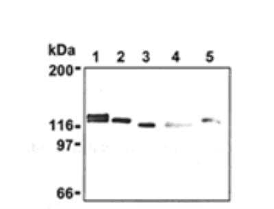 Western Blot: Drebrin 1 Antibody (M2F6) [NB100-1951] - Analysis of Drebrin expression in mouse brain (1) NIH/3T3 (2), Jurkat (3), HeLa (4), and PC12 (5)