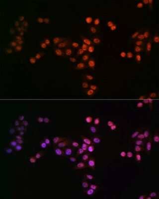 Immunocytochemistry/Immunofluorescence: Drosha Antibody (4R0B7) [NBP3-15804] - Immunofluorescence analysis of HeLa cells using Drosha antibody (NBP3-15804). Blue: DAPI for nuclear staining.