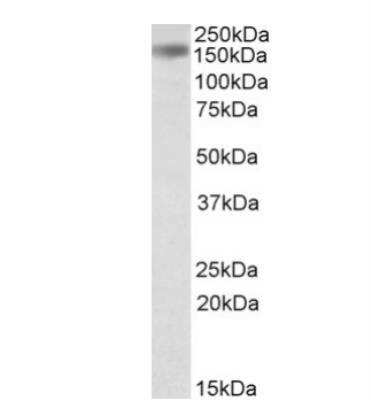 Western Blot: Drosha Antibody [NB100-55410] - Staining of Human Liver lysate (35 ug protein in RIPA buffer) with antibody at 0.3 ug/mL. Primary incubation was 1 hour. Detected by chemiluminescence. Approx. 150-160 kDa band observed in human liver lysates (calculated MW of 151 kDa band according to NP_081075.2).