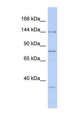 Western Blot: Drosha Antibody [NBP1-57139] - Human Spleen lysate, concentration 0.2-1 ug/ml.