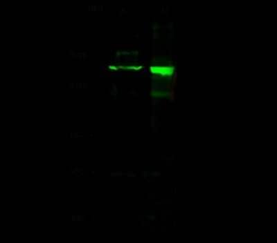 Western Blot: Drosha Antibody [NBP2-99092] - Anti-Drosha rabbit polyclonal antibody at 1:500 dilution. Lane A: Jurkat Whole Cell Lysate. Lane B: 293 Whole Cell Lysate. Lysates/proteins at 30 ug per lane. Secondary Goat Anti- Rabbit  IgG H&L (Dylight 800)  at 1/10000 dilution. Developed using the Odyssey technique. Performed under reducing conditions. Predicted band size: 159 kDa. Observed band size: 159 kDa (We are unsure as to the identity of these extra bands).