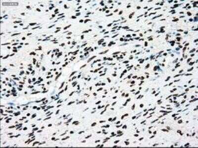 Immunohistochemistry: Dtk/TYRO3 Antibody (OTI2C4) - Azide and BSA Free [NBP2-71331] - Staining of paraffin-embedded Human lung tissue using anti-TYRO3 mouse monoclonal antibody.