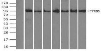 Immunoprecipitation: Dtk/TYRO3 Antibody (OTI2C4) - Azide and BSA Free [NBP2-71331] - Lane 1: Negative Control Lane 2: NBP1-48039 Lane 3: NBP1-48040 Lane 4: NBP1-48041 Lane 5: NBP1-48042 Lane 6: NBP1-48043 Lane 7: NBP1-48044 Lane 8: NBP1-48045