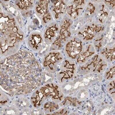 Immunohistochemistry-Paraffin: Dynactin 6 Antibody [NBP1-80617] - Staining of human kidney shows distinct membranous positivity in tubule cells.