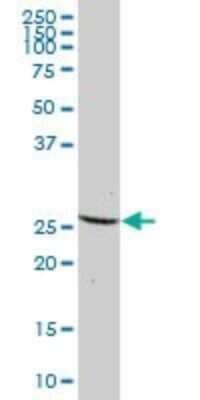 Western Blot: Dynactin 6 Antibody [H00010671-B01P] - Analysis of DCTN6 expression in human liver.