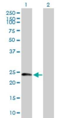 Western Blot: Dynactin 6 Antibody [H00010671-B01P] - Analysis of DCTN6 expression in transfected 293T cell line by DCTN6 polyclonal antibody.  Lane 1: DCTN6 transfected lysate(20.9 KDa). Lane 2: Non-transfected lysate.