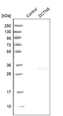 Western Blot: Dynactin 6 Antibody [NBP1-80617] - Analysis in control (vector only transfected HEK293T lysate) and DCTN6 over-expression lysate (Co-expressed with a C-terminal myc-DDK tag (~3.1 kDa) in mammalian HEK293T cells, LY401967).