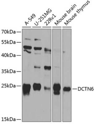 Western Blot: Dynactin 6 Antibody [NBP2-92536] - Analysis of extracts of various cell lines, using Dynactin 6 at 1:1000 dilution.Secondary antibody: HRP Goat Anti-Rabbit IgG (H+L) at 1:10000 dilution.Lysates/proteins: 25ug per lane.Blocking buffer: 3% nonfat dry milk in TBST.Detection: ECL Basic Kit .Exposure time: 30s.