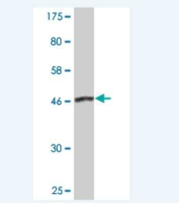 Western Blot: Dynactin Subunit 1/DCTN1 Antibody (2E4-1C2) [H00001639-M02] - Detection against Immunogen (47.52 KDa) .