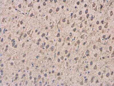 Immunohistochemistry-Paraffin: Dynactin Subunit 1/DCTN1 Antibody [NBP1-30880] - Paraffin-embedded Rat brain. DCTN1 antibody [C3], C-term  diluted at 1:500.