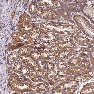 Immunohistochemistry-Paraffin: Dynactin Subunit 1/DCTN1 Antibody [NBP2-33976] - Staining of human stomach, lower shows strong cytoplasmic and membranous positivity in glandular cells.