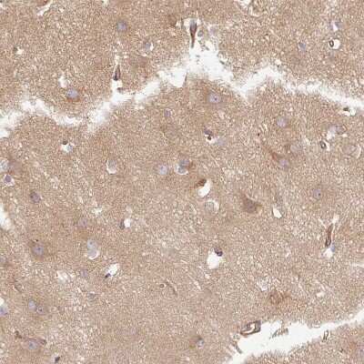 Immunohistochemistry-Paraffin: Dynactin Subunit 1/DCTN1 Antibody [NBP2-33976] - Staining of human Cerebral cortex shows weak cytoplasmic positivity in neuronal cells.