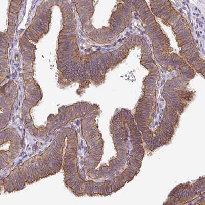 Immunohistochemistry-Paraffin: Dynactin Subunit 1/DCTN1 Antibody [NBP2-33976] - Staining of human Fallopian tube shows strong membranous and cytoplasmic positivity in glandular cells.