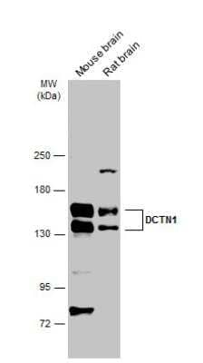 Western Blot: Dynactin Subunit 1/DCTN1 Antibody [NBP1-30880] - Various tissue extracts (50 ug) were separated by 5% SDS-PAGE, and the membrane was blotted with DCTN1 antibody [C3], C-term  diluted at 1:2000. The HRP-conjugated anti-rabbit IgG antibody (NBP2-19301) was used to detect the primary antibody.