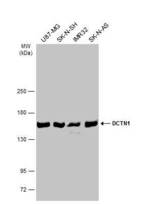 Western Blot: Dynactin Subunit 1/DCTN1 Antibody [NBP1-30880] - Various whole cell extracts (30 ug) were separated by 5% SDS-PAGE, and the membrane was blotted with DCTN1 antibody [C3], C-term  diluted at 1:2500. The HRP-conjugated anti-rabbit IgG antibody (NBP2-19301) was used to detect the primary antibody.