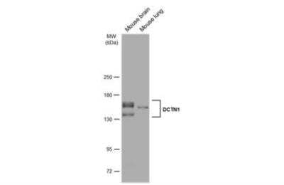 Western Blot: Dynactin Subunit 1/DCTN1 Antibody [NBP1-30880] - Various tissue extracts (50 ug) were separated by 5% SDS-PAGE, and the membrane was blotted with DCTN1 antibody [C3], C-term (NBP1-30880). The HRP-conjugated anti-rabbit IgG antibody was used to detect the primary antibody.