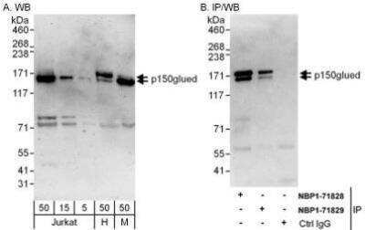 Western Blot: Dynactin Subunit 1/DCTN1 Antibody [NBP1-71829] - Whole cell lysate from Jurkat (5, 15 and 50 mcg for WB), HeLa (H, 50 mcg; 1 mg for IP, 20% of IP loaded) and mouse NIH3T3 (M; 50 mcg) cells.  Affinity purified rabbit anti-p150glued antibody used for WB at 0.1 mcg/ml (A) and 1 mcg/ml (B) and used for IP at 6 mcg/mg lysate.  p150glued was also immunoprecipitated by rabbit anti-p150glued antibody NBP1-71828, which recognizes an upstream epitope.