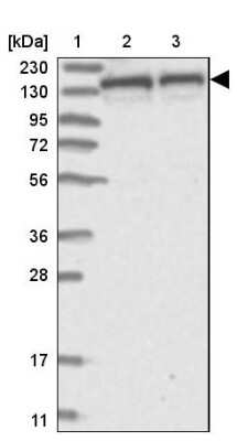 Western Blot: Dynactin Subunit 1/DCTN1 Antibody [NBP2-33976] - Lane 1: Marker  [kDa] 230, 130, 95, 72, 56, 36, 28, 17, 11.  Lane 2: Human cell line RT-4.  Lane 3: Human cell line U-251MG sp