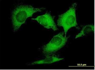 Immunocytochemistry/Immunofluorescence: Dynactin Subunit 2/DCTN2/DCTN-50 Antibody [H00010540-B01P] - Analysis of purified antibody to DCTN2 on HeLa cell. (antibody concentration 10 ug/ml)